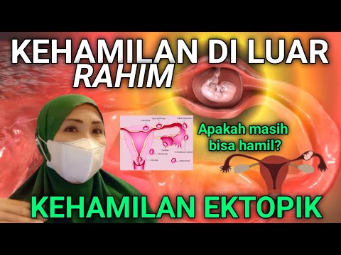 Video: Adakah kehamilan luar rahim akan sembuh dengan sendirinya?