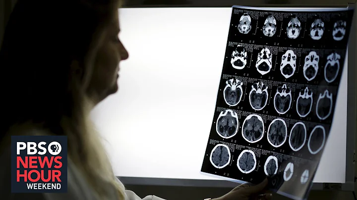 Racial bias in widely used hospital algorithm, study finds