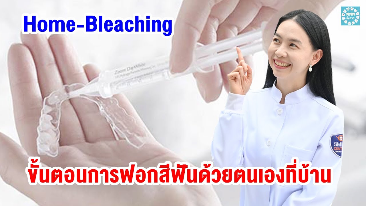 ขั้นตอนการฟอกสีฟันด้วยตนเองที่บ้าน (ชุดฟอกสีฟันแบบHome-Bleaching)