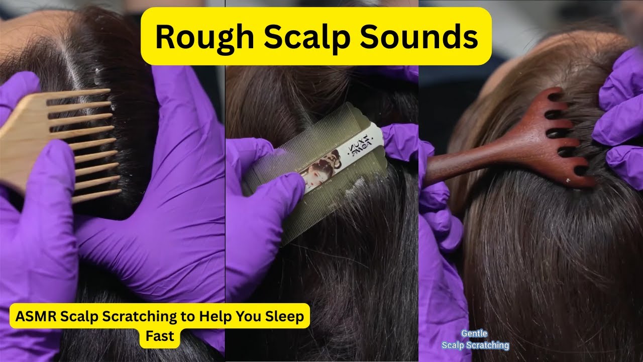 ASMR Scalp Scratching to Help You Sleep Fast #15