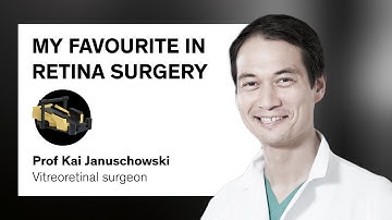 OS 4: All in one experience | What excites me the most about Oertli | Kai Januschowski | #001