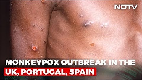 Explained: What Is Monkeypox And Why Cases Are Rising In Europe