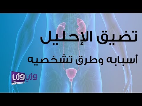 فيديو: ماذا يعني استئصال الإحليل؟