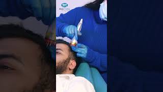 Hair Re-Growth System