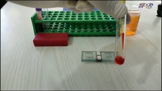 Absolute eosinophil count | AEC test | Complete Lecture with Practical by neubauer chamber in hindi