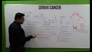 Cervix Cancer Hindi | NCLEX | Symptoms of cervix cancer | Types | Treatment |  Nursing Consideration
