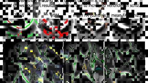 DTI Analysis VoxelBased audio