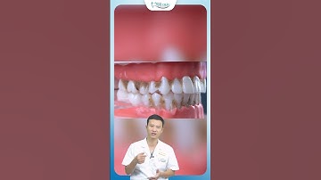Cách Vệ Sinh Bằng Máy Tăm Nước | Bác Sĩ Yên