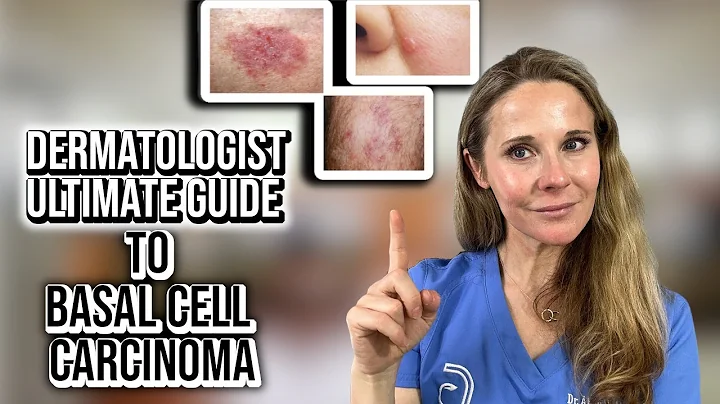 Dermatologist ultimate guide to Basal Cell Carcinoma