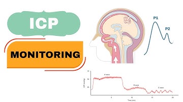 ICP Monitoring II How to Monitor ICP in ICU II ICP Waves II Lundberg Waves II Intracranial pressure