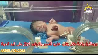 سبحان الله : ولادة طفل بقلب خارج الصدر والمولود لازال على قيد الحياة