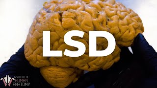Lo que el LSD le hace a TU cerebro...