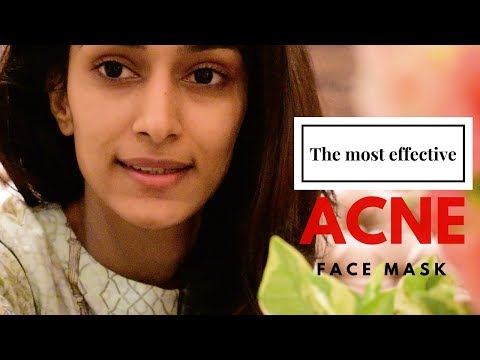 MOST EFFECTIVE ACNE FACE MASK  | ACNE | SKINCARE | ERICA FERNANDES