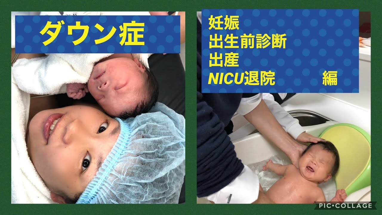ダウン症の動画 画像 動画検索 マイルドサイト