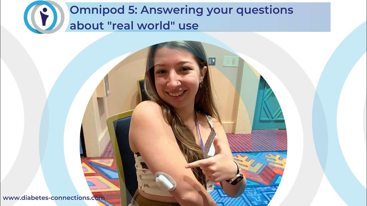Omnipod 5 Answering your questions about "real world" use YouTube