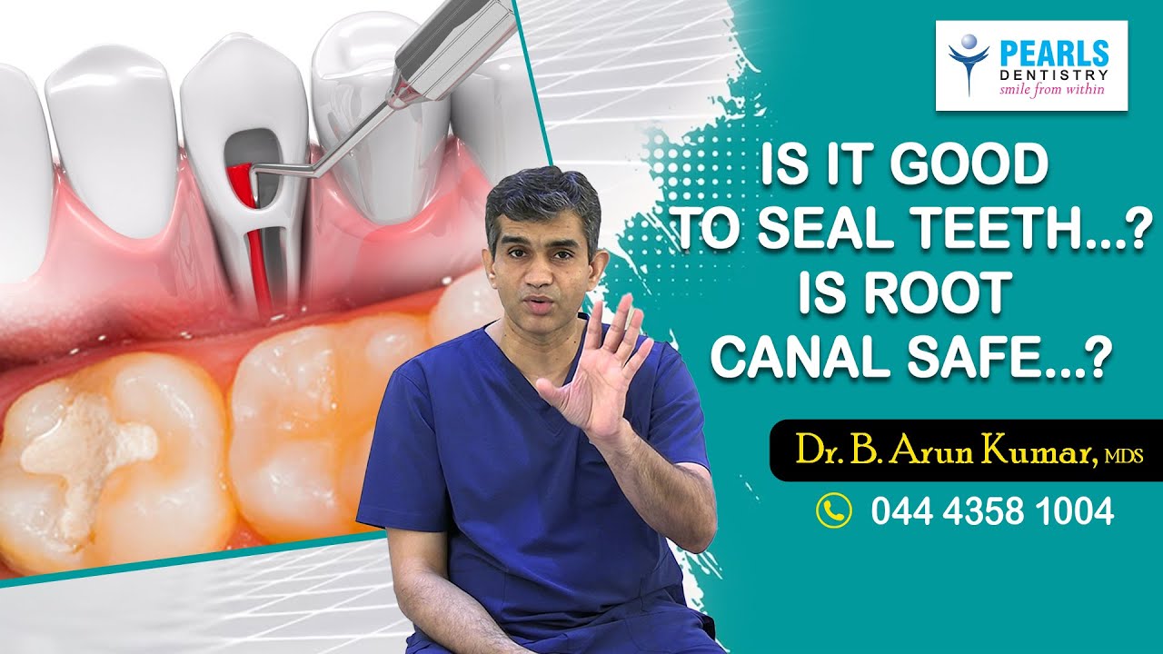 Is it good to Seal teeth..? Is Root Canal safe…?Pearls Dentistry..Dr