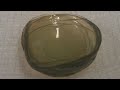 Doctors find 27 contact lenses in woman's eye