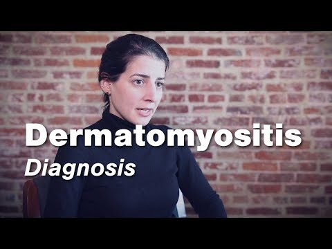 Video: Dermatomyositis - Symptomen, Behandeling, Vormen, Stadia, Diagnose