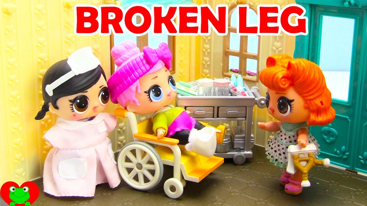 Lol Surprise Doll Falls Off Ladder Broken Leg Broken Leg Cute Toys Dolls