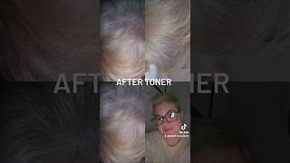 #BeforeandAfter