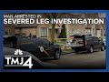 Man who owns home connected to severed leg investigation being held in milwaukee county jail