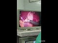 #laproscopy #government hospital
