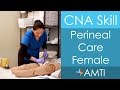 CNA Skill: Perineal Care Female