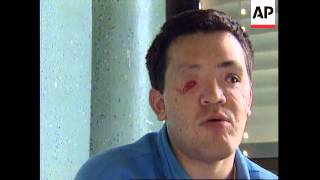 BOSNIA: SOLDIER BLINDED IN FINAL DAYS OF BOSNIAN CONFLICT
