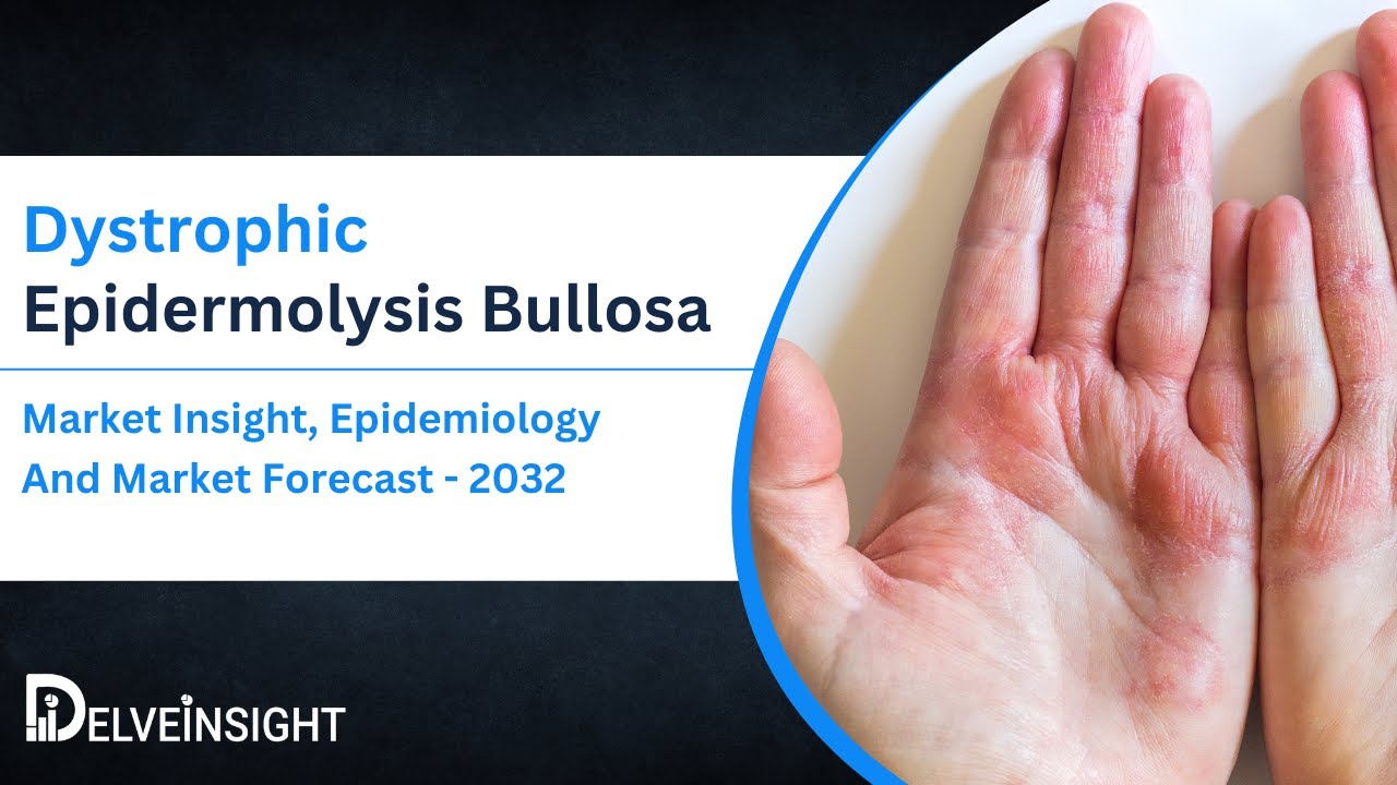Dystrophic Epidermolysis Bullosa Market Size was more than USD 500 ...