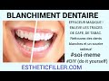 Whitening teeth blanchiment dentaire chez soi en 30 secondes