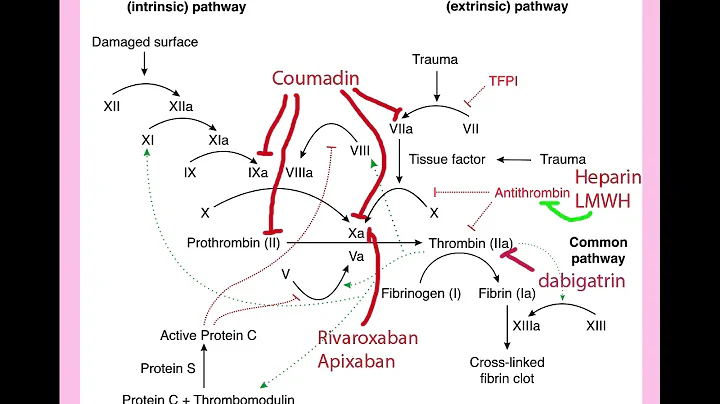 Thrombophilia in Pregnancy - CRASH! Medical Review...