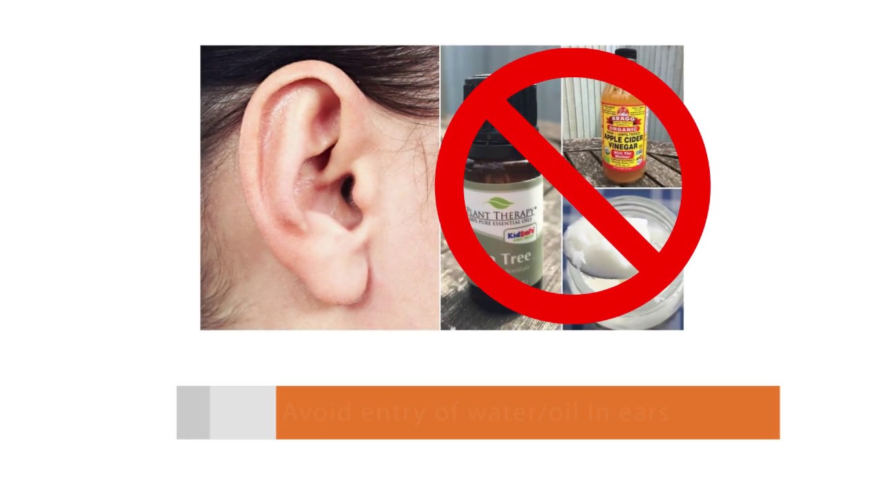 Post Ear Surgery Care How to Take Care After Eardrum Surgery Best
