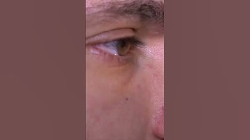 "You Have a Blind Spot 👁️ (And You Don’t Even Notice!)" | #Shorts