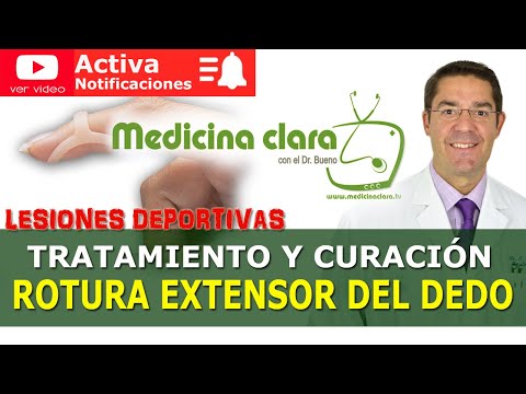 Rotura tendones en dedos mano, rotura extensor | Medicina Clara