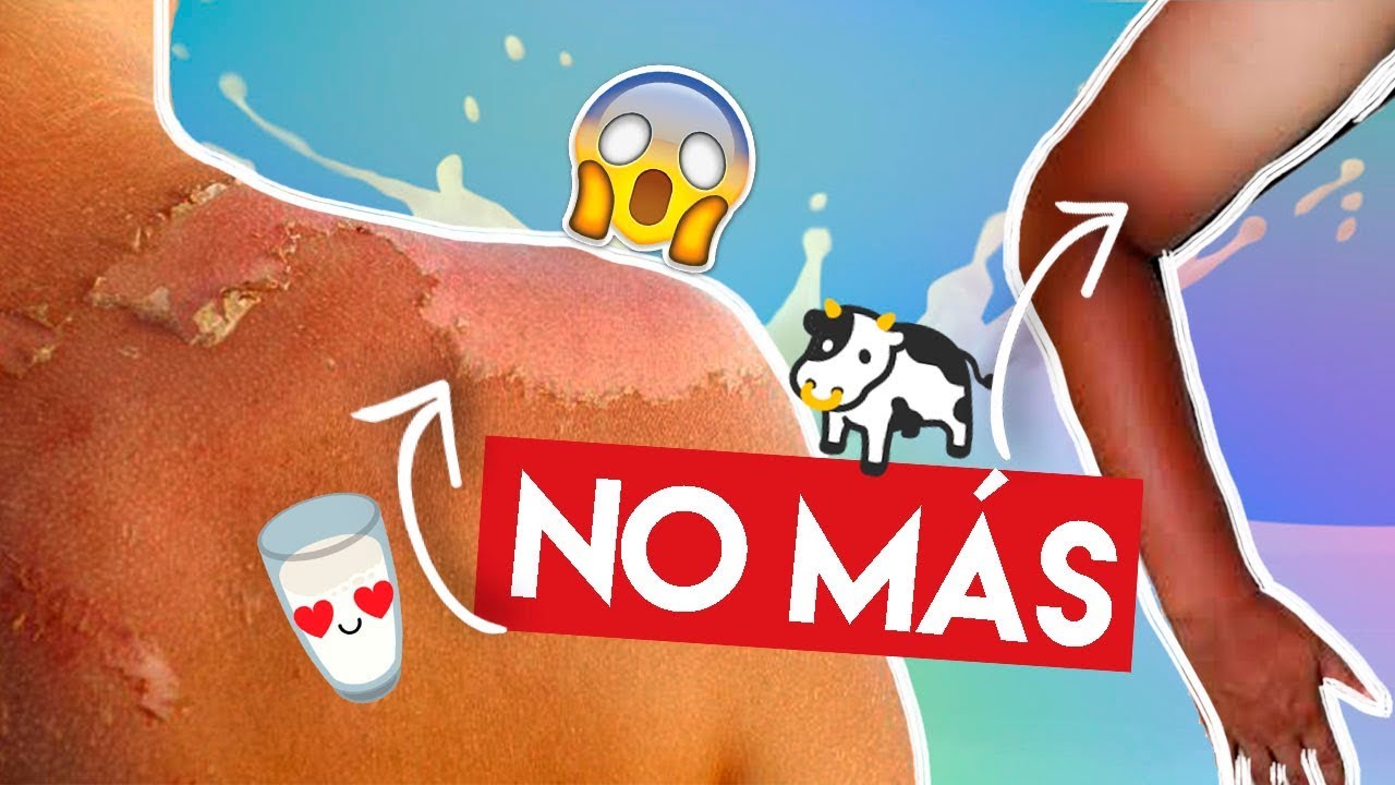 Recupera Tu Tono De Piel Aclara Y Desmancha Youtube