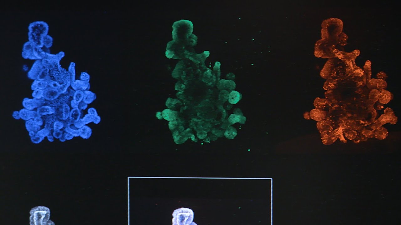 Growing mini organs to find new ways of fighting cancer