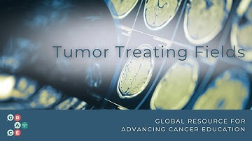 Tumor Treating Fields: An Overview- Mesothelioma and Glioblastoma, 2024