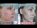 I tried curology for postacne markshyperpigmentation  4 month results  review not sponsored