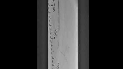 Engaging Proximal SFA CTO with Viance