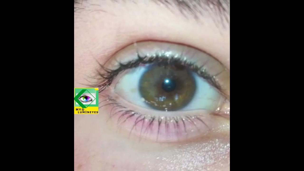 can you change your eyes color? naturally or laser or Surgery ? YouTube