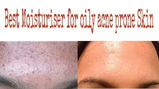 emolene moisturiser for oily skin