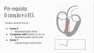 Reconhecimento de Arritmias Cardíacas com Aprendizado de Máquina - Parte 1