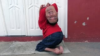 Upside Down Man Body Bizarre Episode 1