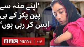 Kiran Ishtiaq: Story of a girl born without arms and legs who never gave up. BBC URDU