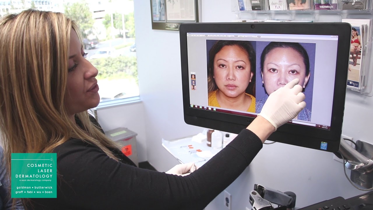 Banner for Botox Injections to Enhance Female Cheek Prominence | Demonstrated by Dr. Sabrina Fabi