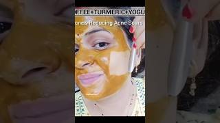 😱 Dark Spots गायब करने का आसान तरीका!#shortvideo #GlassSkin #FacePack #Skincare #DIYBeauty#GlowSkin