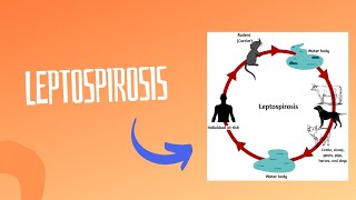 Leptospirosis || Weils Disease