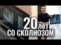 20 лет со сколиозом: не прятаться, а жить!