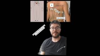 Posição dos eletrodos no eletrocardiograma - como colocar o ECG? Posição dos eletrodos no eletrocardiograma - como colocar o ECG?