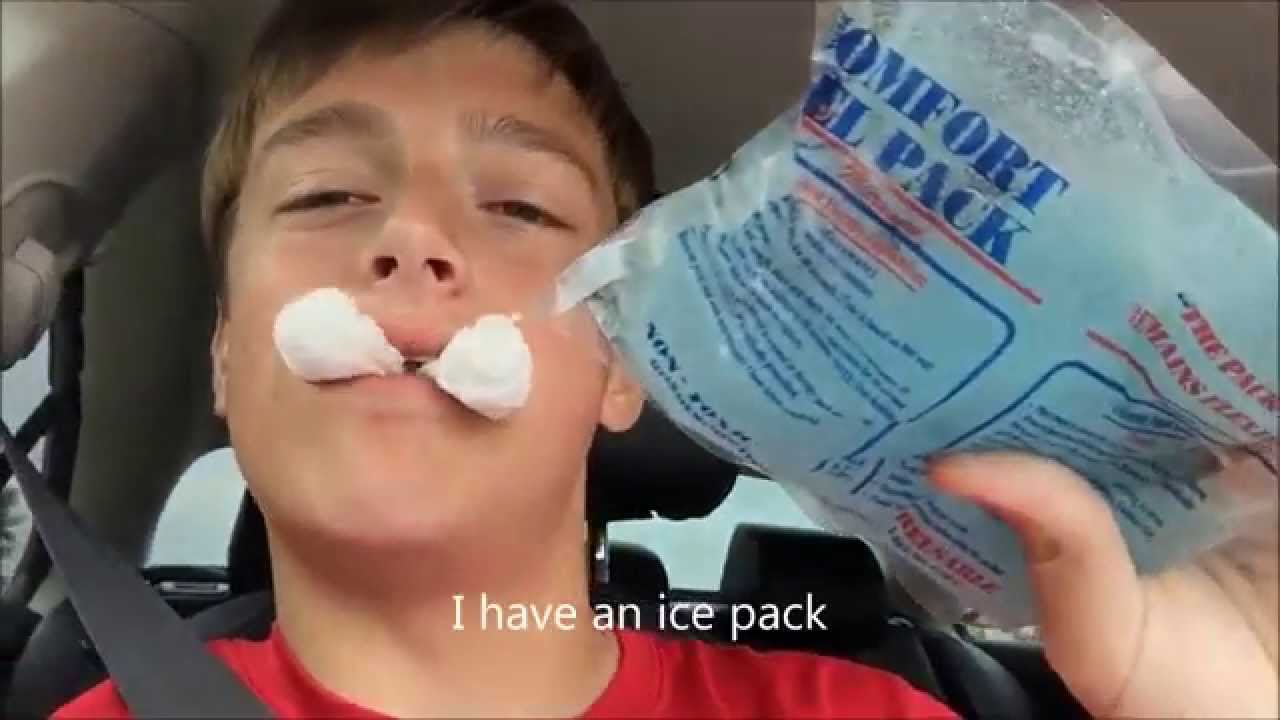 Wisdom Teeth Removal Ballons, Ice Cream and Richard Nixon YouTube